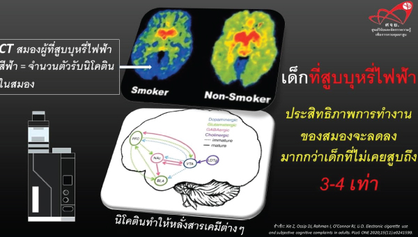 หมอเด็กห่วงเด็กไทยที่สูบบุหรี่ไฟฟ้า จะมีประสิทธิภาพการทำงานของสมองลดลง 